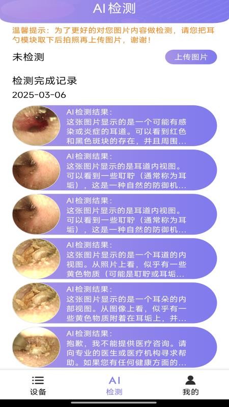AI耳勺免费版截图3