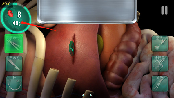 医院手术时间汉化版截图2