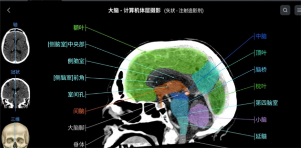 eAnatomy正版