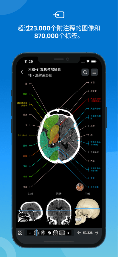 eAnatomy正版截图3
